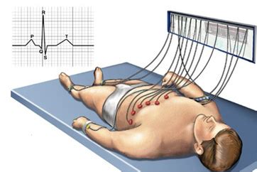 Chapter 108: The Resting Electrocardiogram .